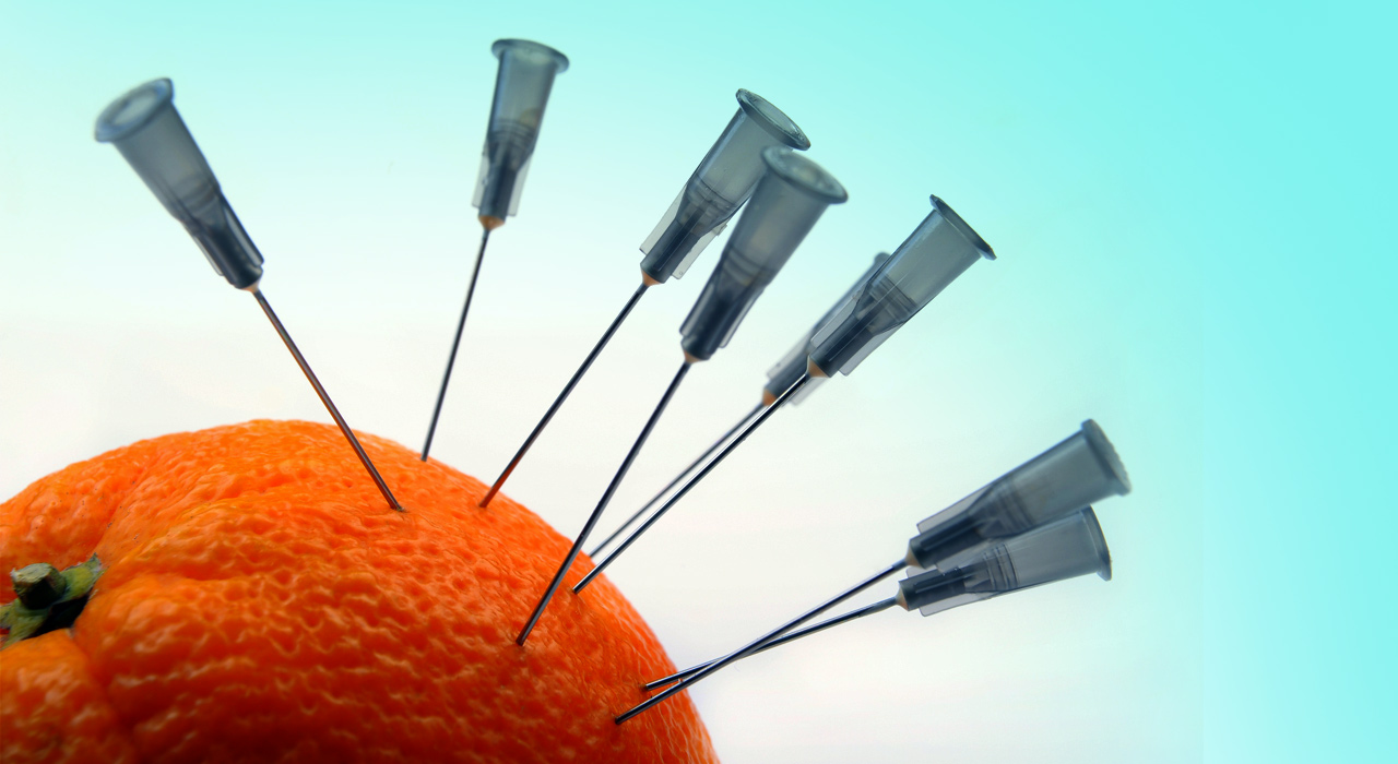 an orange with acupuncture needles in it